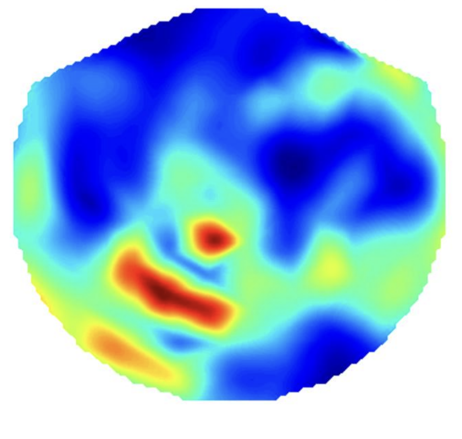 Brain-Computer Interface thumbnail